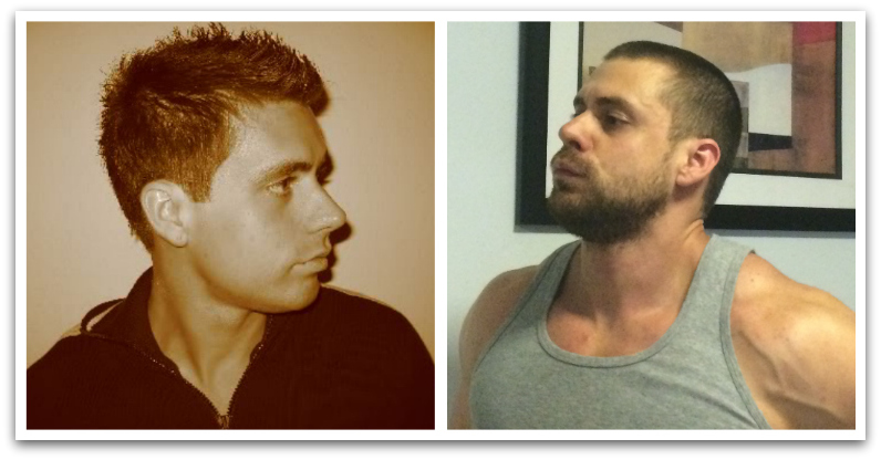 vprideneckbeforeafter